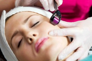 micro-needling-derma-roller-london-620x412