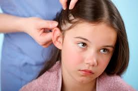 10 Ways to Kill Head Lice