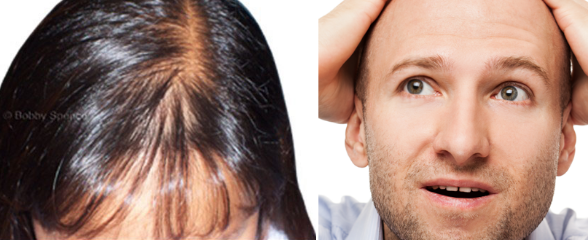 Hair Loss Treatment Product in Pakistan