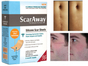 scar away