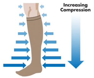 Compression Stockings
