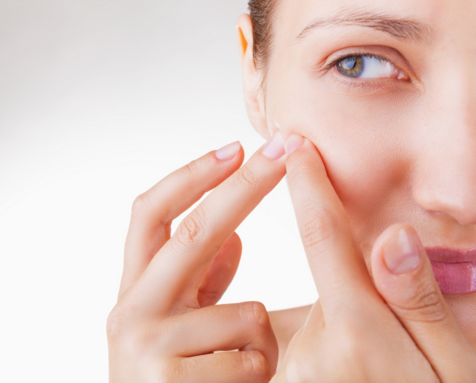 Pop out the pimples the smart way