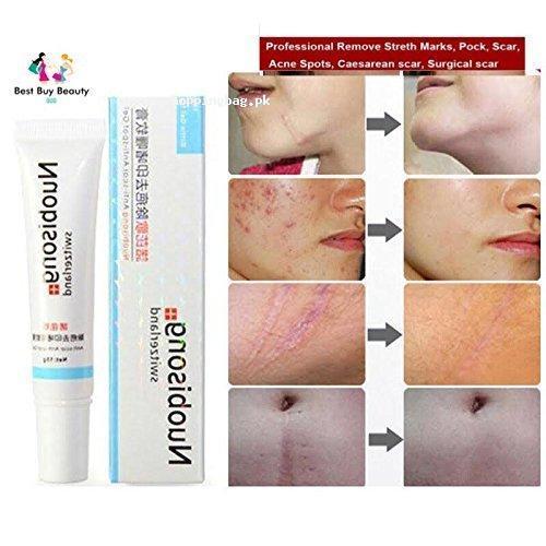 Nuobisong Acne Scar Stretch Marks Removal Cream